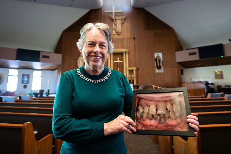 Patient Shirley's smile before and after dental implants
