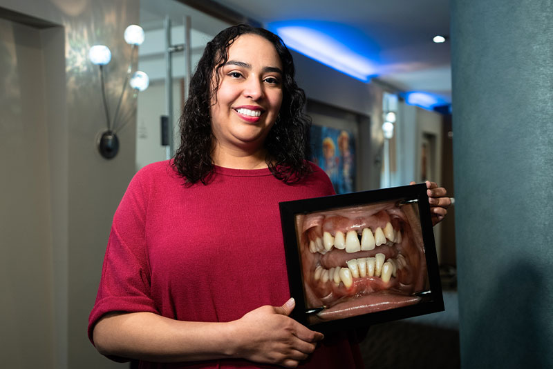 Patient Iris's smile before and after dental implants