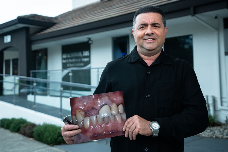 Patient Hamid's smile before and after dental implants
